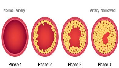 cholesterol artikel